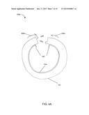 PROTECTIVE BIB FOR CONTAINER diagram and image