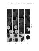 In Vitro Production of Medial Ganglionic Eminence Precursor Cells diagram and image