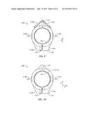 LARGE DIAMETER TUBULAR LIFTING APPARATUSES AND METHODS diagram and image