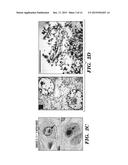 METHODS AND ASSAYS RELATING TO RNF216 diagram and image