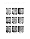 METHODS AND ASSAYS RELATING TO RNF216 diagram and image