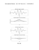 Spatial Localization of Intermittent Noise Sources By Acoustic Antennae diagram and image