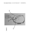 CABLE RETRACTION SYSTEM diagram and image