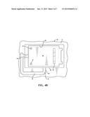 A Method Of Encapsulating An Electric Component diagram and image