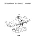 METHODS AND STEERING DEVICE FOR MINIMALLY INVASIVE VISUALIZATION SURGERY     SYSTEMS diagram and image