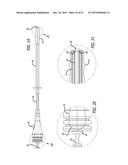 ENDOTRACHEAL INTUBATION DEVICES diagram and image