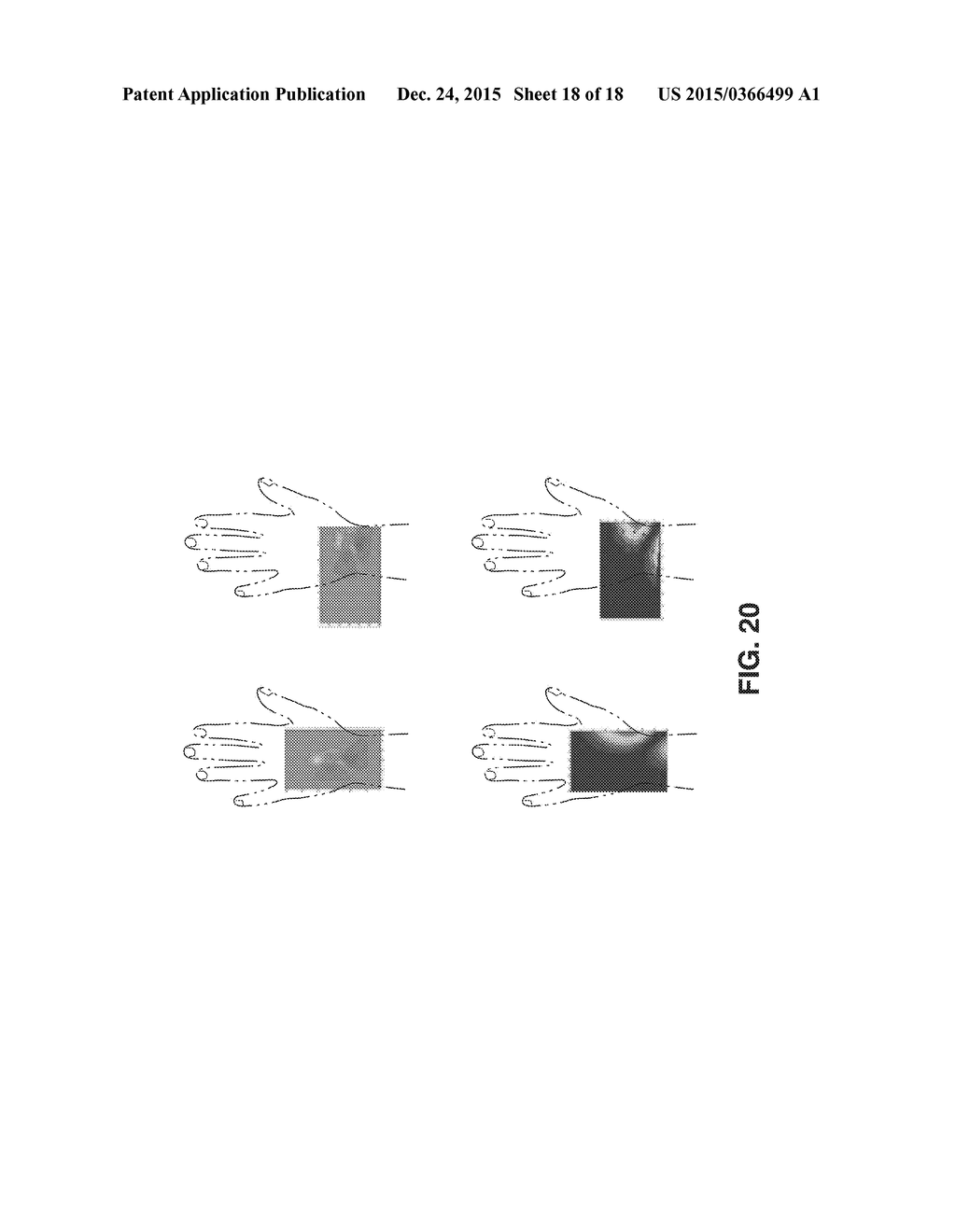 SEM SCANNER SENSING APPARATUS, SYSTEM AND METHODOLOGY FOR EARLY DETECTION     OF ULCERS - diagram, schematic, and image 19