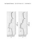 Dynamic adaptive respiration compensation with automatic gain control diagram and image