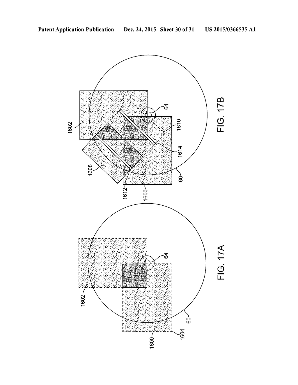 METHOD, APPARATUS AND SYSTEM FOR COMPLETE EXAMINATION OF TISSUE WITH     HAND-HELD IMAGING DEVICES HAVING MOUNTED CAMERAS - diagram, schematic, and image 31