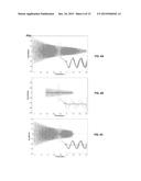 ULTRASOUND IMAGING SYSTEM USING BEAMFORMING TECHNIQUES FOR PHASE COHERENCE     GRATING LOBE SUPPRESSION diagram and image