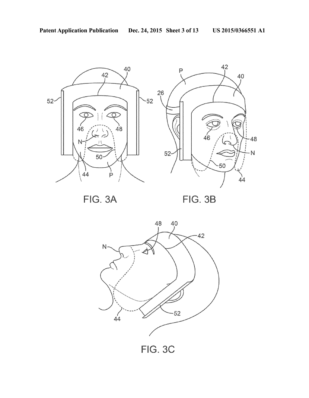 PATIENT-SUPPORTED OPHTHALMIC PLATFORMS - diagram, schematic, and image 04