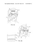 PATIENT-SUPPORTED OPHTHALMIC PLATFORMS diagram and image