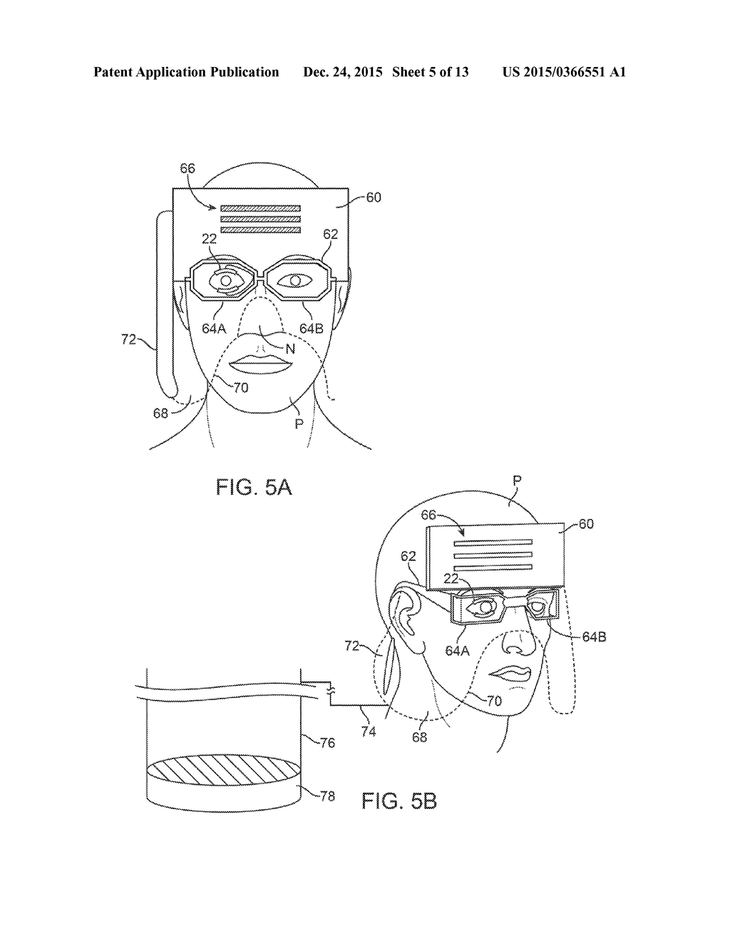 PATIENT-SUPPORTED OPHTHALMIC PLATFORMS - diagram, schematic, and image 06