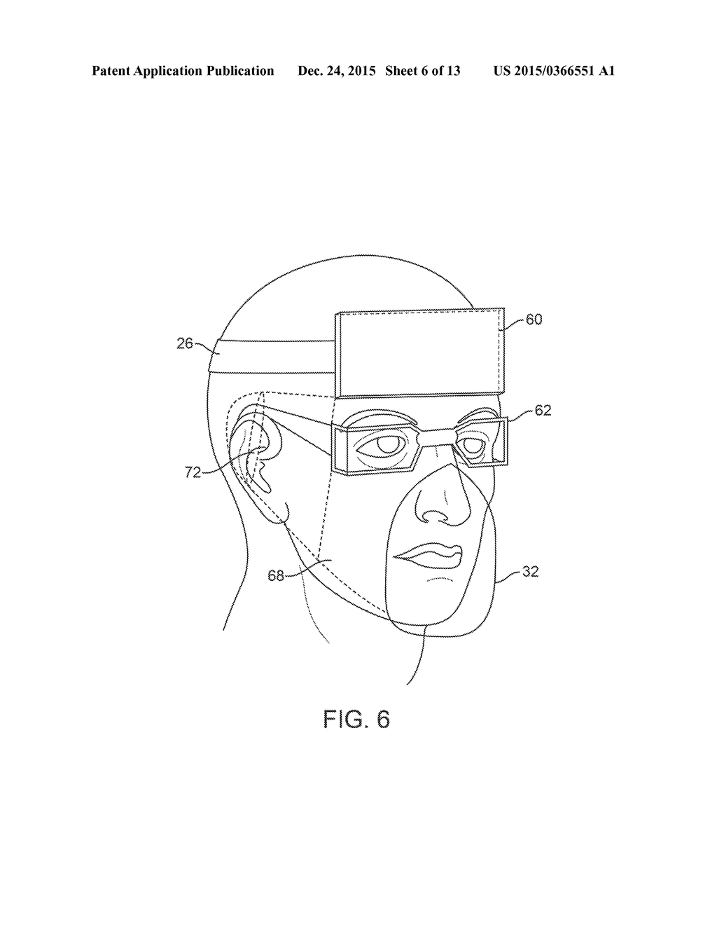 PATIENT-SUPPORTED OPHTHALMIC PLATFORMS - diagram, schematic, and image 07