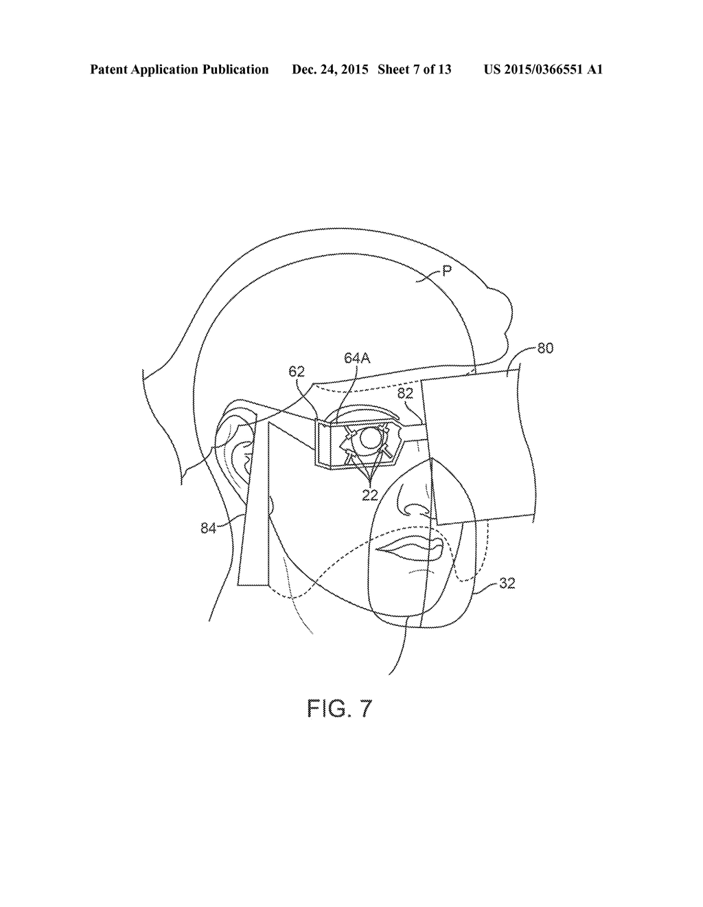 PATIENT-SUPPORTED OPHTHALMIC PLATFORMS - diagram, schematic, and image 08