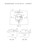 PATIENT-SUPPORTED OPHTHALMIC PLATFORMS diagram and image