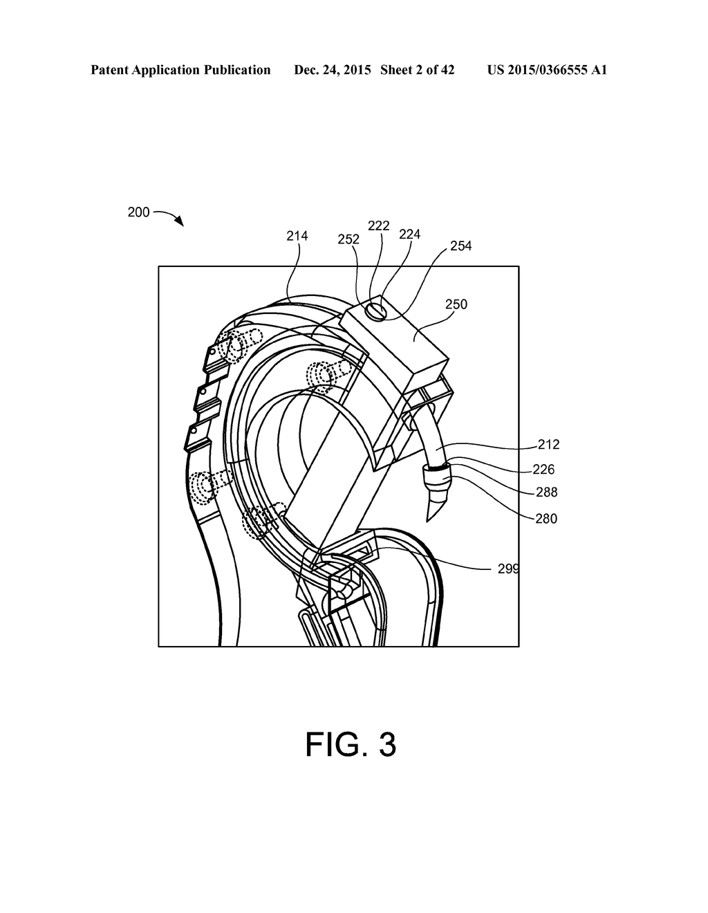 INSERTION DEVICES, ANCHORS, AND METHODS FOR SECURING AN IMPLANT - diagram, schematic, and image 03