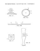 APPARATUS AND METHOD TO PROVIDE EMERGENCY ACCESS TO BONE MARROW diagram and image