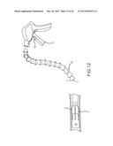 SELECTIVELY BENDABLE REMOTE GRIPPING TOOL diagram and image