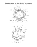 CANNULA AND METHODS OF USE diagram and image