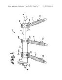 Dynamic stabilization members with elastic and inelastic sections diagram and image