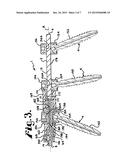 Dynamic stabilization members with elastic and inelastic sections diagram and image