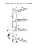 Dynamic stabilization members with elastic and inelastic sections diagram and image