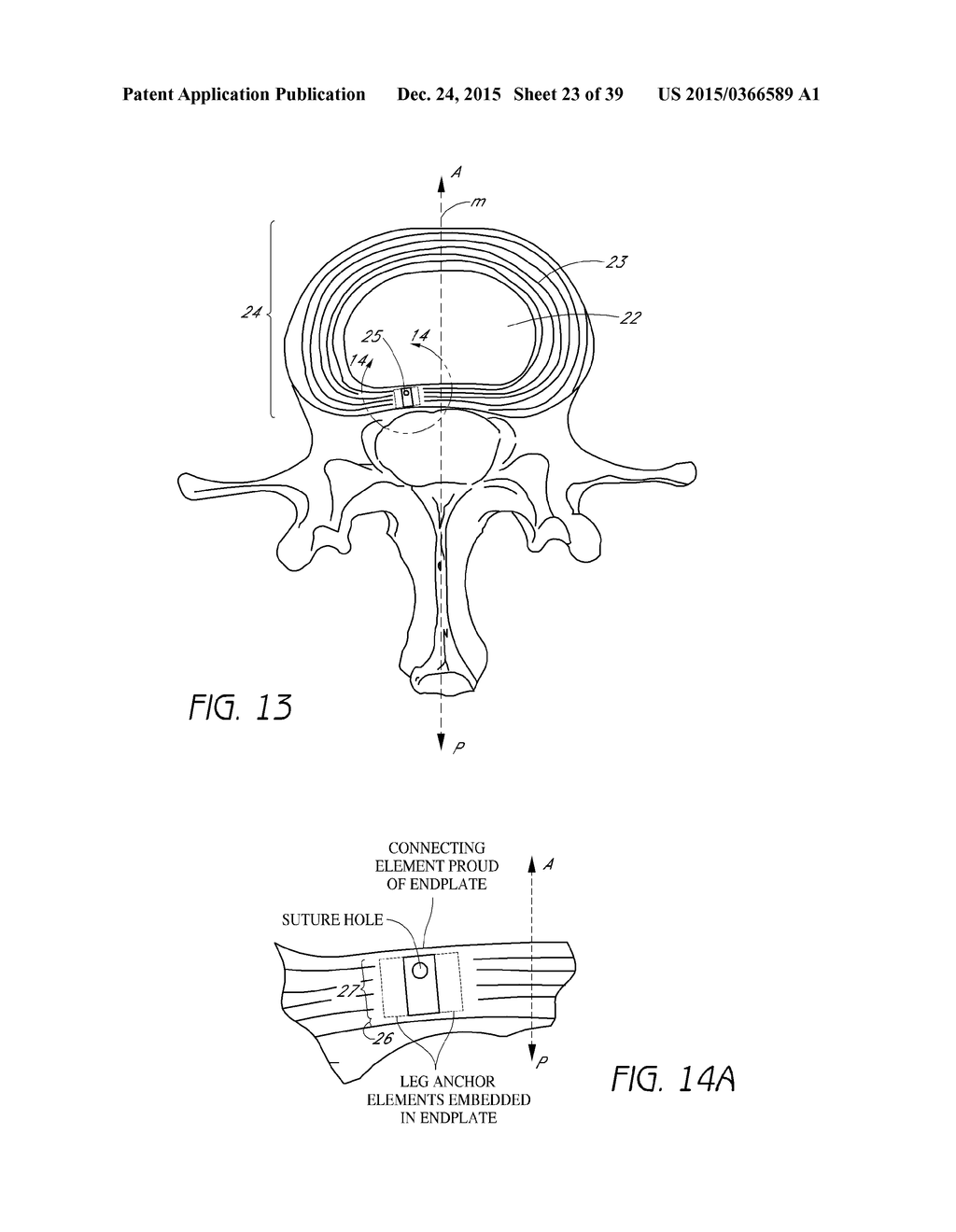 BONE ANCHOR SYSTEMS - diagram, schematic, and image 24