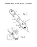 Periprosthetic Plating System Including Plate with System for Retaining     Tension on a Cable diagram and image