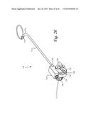 Periprosthetic Plating System Including Plate with System for Retaining     Tension on a Cable diagram and image