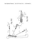 Periprosthetic Plating System Including Plate with System for Retaining     Tension on a Cable diagram and image