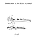 Periprosthetic Plating System Including Plate with System for Retaining     Tension on a Cable diagram and image