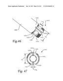 Periprosthetic Plating System Including Plate with System for Retaining     Tension on a Cable diagram and image