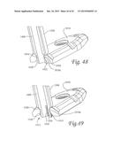 Periprosthetic Plating System Including Plate with System for Retaining     Tension on a Cable diagram and image