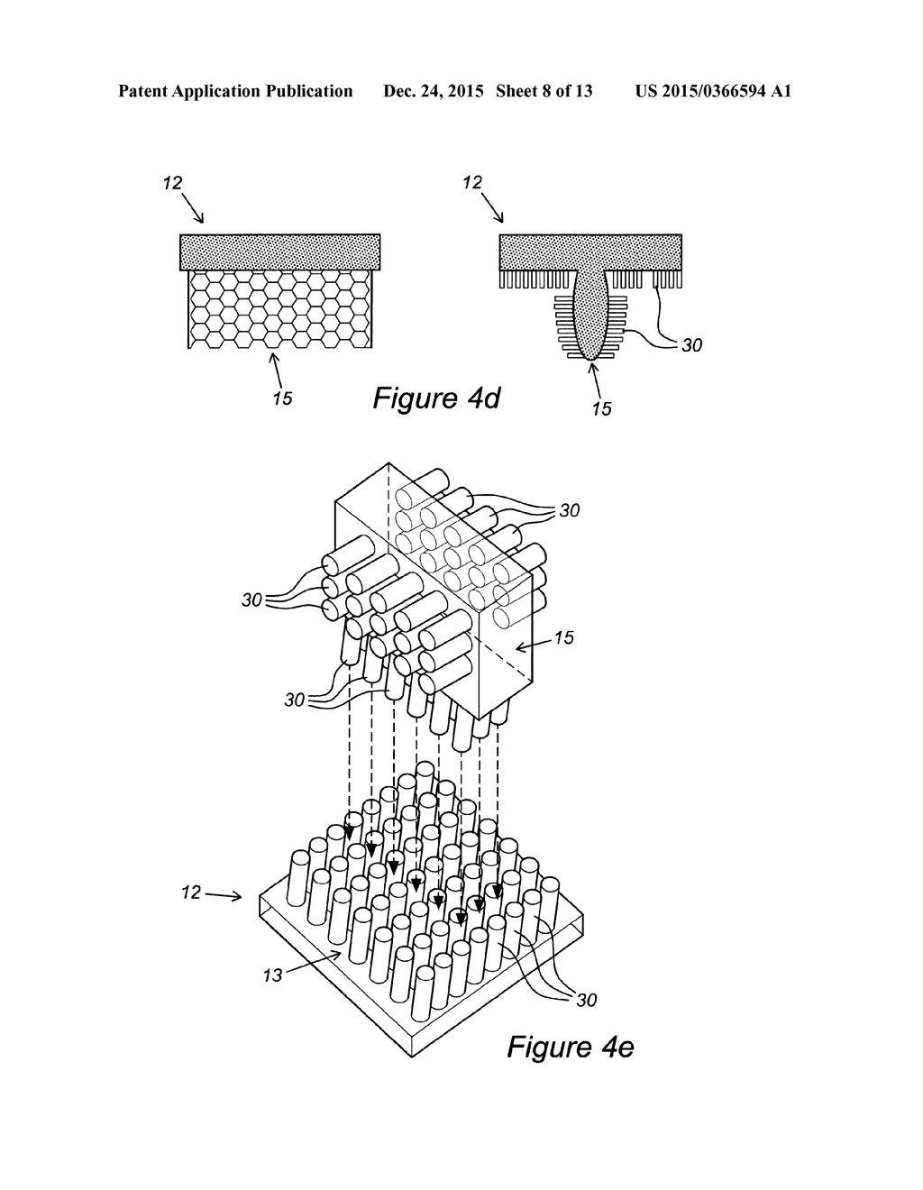 ARTICULAR FRACTURE FIXATION SYSTEM AND METHOD - diagram, schematic, and image 09