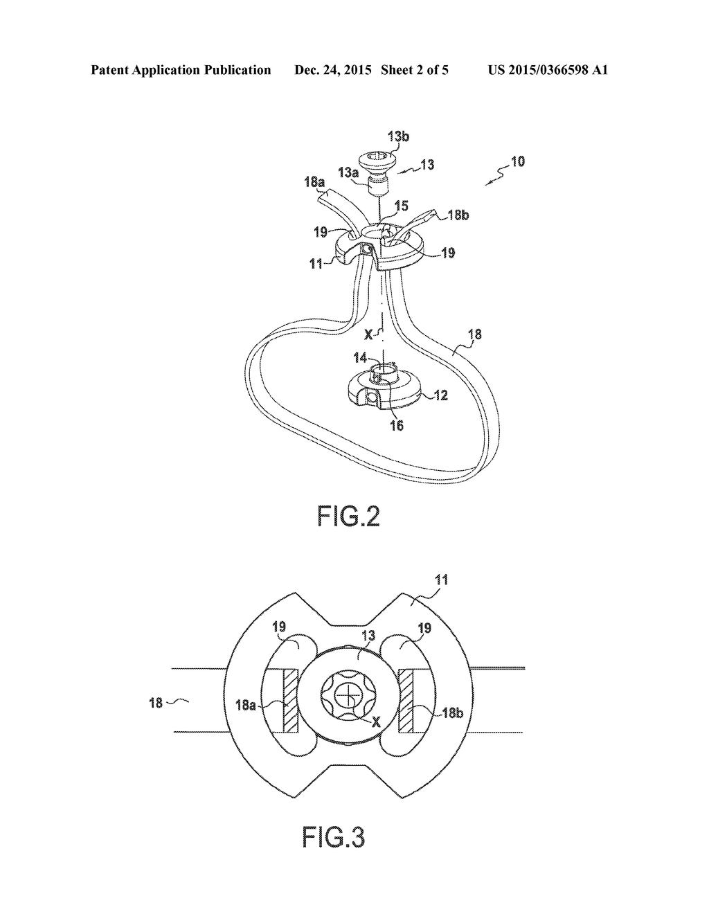 DEVICE AND METHOD FOR SECURING A LIGATURE TO AN OSSEOUS STRUCTURE - diagram, schematic, and image 03