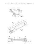 MEDICAL DEVICE, APPARATUS, AND SURGICAL METHOD diagram and image