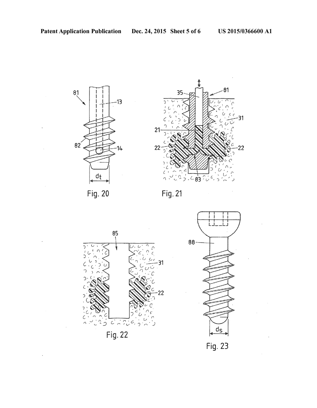 MEDICAL DEVICE, APPARATUS, AND SURGICAL METHOD - diagram, schematic, and image 06