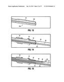 SYSTEMS AND METHODS FOR TREATING TISSUE WITH RADIOFREQUENCY ENERGY diagram and image