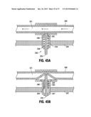 SYSTEMS AND METHODS FOR TREATING TISSUE WITH RADIOFREQUENCY ENERGY diagram and image