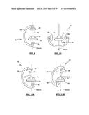 Surgical Monitoring System and Related Methods diagram and image