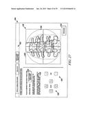 Surgical Monitoring System and Related Methods diagram and image