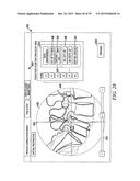 Surgical Monitoring System and Related Methods diagram and image