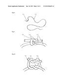 SUTURE TO BE USED IN PRODUCING MEDICAL INSTRUMENT PROVIDED WITH SUTURED     PART, METHOD FOR USING SAME AND MEDICAL INSTRUMENT SEWN USING SAME diagram and image