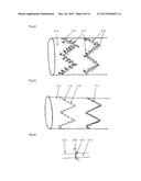 SUTURE TO BE USED IN PRODUCING MEDICAL INSTRUMENT PROVIDED WITH SUTURED     PART, METHOD FOR USING SAME AND MEDICAL INSTRUMENT SEWN USING SAME diagram and image