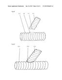 SUTURE TO BE USED IN PRODUCING MEDICAL INSTRUMENT PROVIDED WITH SUTURED     PART, METHOD FOR USING SAME AND MEDICAL INSTRUMENT SEWN USING SAME diagram and image