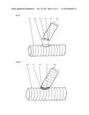 SUTURE TO BE USED IN PRODUCING MEDICAL INSTRUMENT PROVIDED WITH SUTURED     PART, METHOD FOR USING SAME AND MEDICAL INSTRUMENT SEWN USING SAME diagram and image