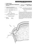 Arthroscopic Method and Apparatus for Rotator Cuff Repair diagram and image