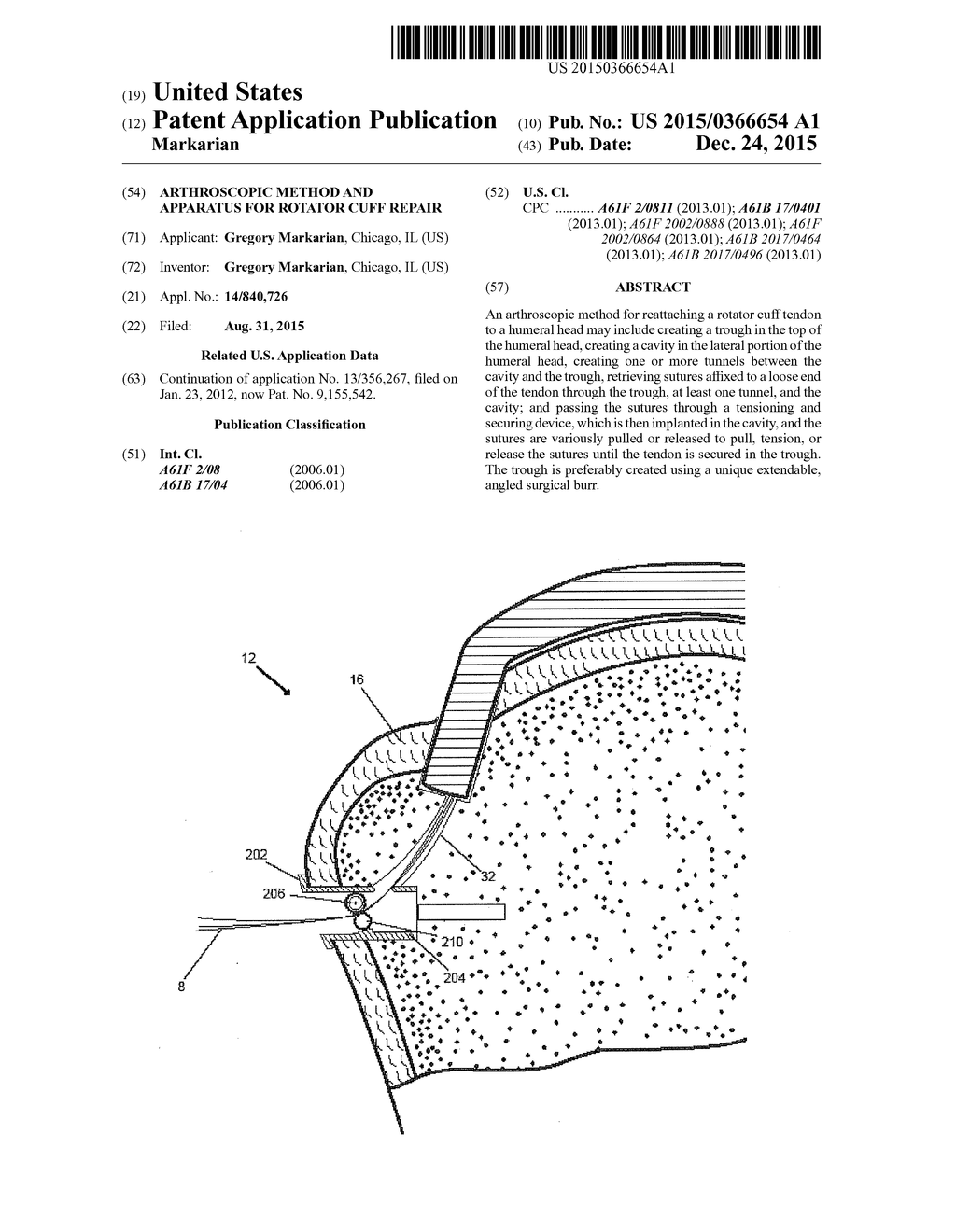 Arthroscopic Method and Apparatus for Rotator Cuff Repair - diagram, schematic, and image 01