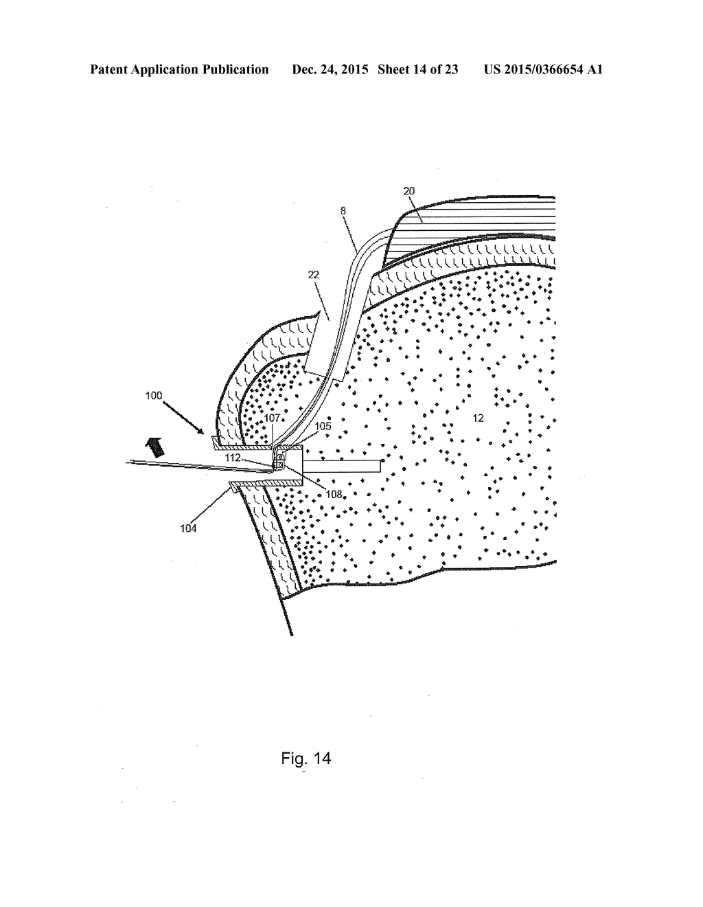 Arthroscopic Method and Apparatus for Rotator Cuff Repair - diagram, schematic, and image 15